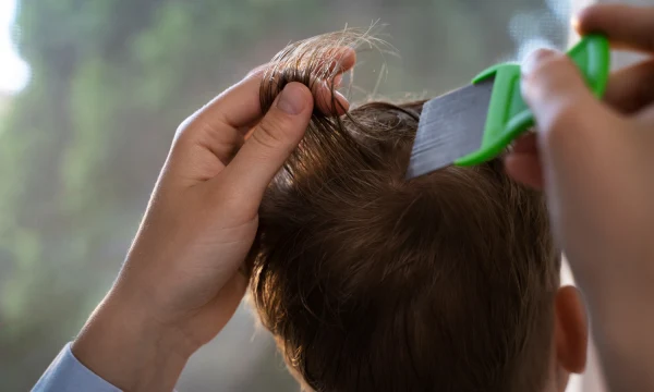 Дезинсекция вшей: как эффективно бороться с паразитами