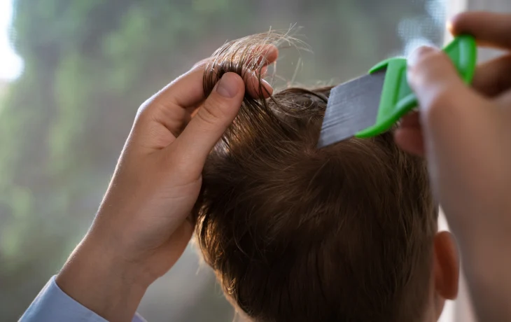 Дезинсекция вшей: как эффективно бороться с паразитами